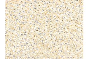 ABIN7094232 and ABIN7098279 at 1/100 staining Mouse liver tissue by IHC-P.