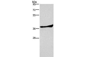 Western Blot analysis of Human fetal liver tissue using AMPK gamma1 Polyclonal Antibody at dilution of 1:300 (PRKAG1 anticorps)