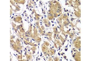 Immunohistochemistry of paraffin-embedded Human gastric using DGKE Polyclonal Antibody at dilution of 1:100 (40x lens). (DGKE anticorps)