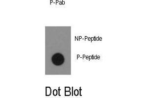 Image no. 1 for anti-C-Abl Oncogene 1, Non-Receptor tyrosine Kinase (ABL1) (pTyr134) antibody (ABIN358067) (ABL1 anticorps  (pTyr134))