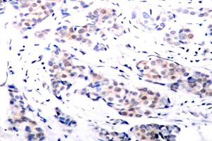 Image no. 2 for anti-ELK1, Member of ETS Oncogene Family (ELK1) antibody (ABIN265398) (ELK1 anticorps)