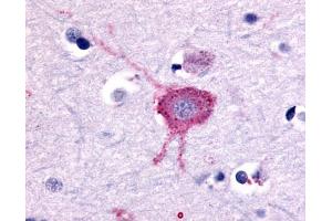 Anti-GRM2 / MGLUR2 antibody IHC of human brain, neurons and glia.