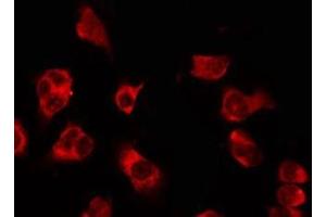 ABIN6278613 staining HeLa by IF/ICC.