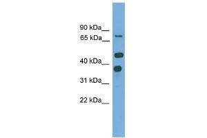 WB Suggested Anti-PTPN11 Antibody Titration: 0. (PTPN11 anticorps  (N-Term))