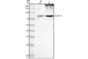Western blot analysis of SLCO1C1 using anti-SLCO1C1 antibody (ABIN7825841).