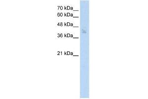 Human MCF7; WB Suggested Anti-SPDEF Antibody Titration: 2. (SPDEF/PSE anticorps  (N-Term))