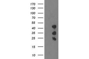 Western Blotting (WB) image for anti-PDZ and LIM Domain 2 (PDLIM2) antibody (ABIN1500129) (PDLIM2 anticorps)