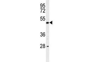 Western blot analysis of RIPK3 antibody and K562 lysate. (RIPK3 anticorps  (AA 489-518))