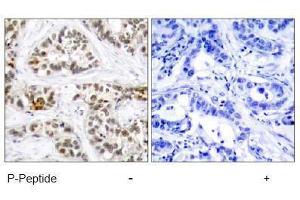 Image no. 2 for anti-V-Rel Reticuloendotheliosis Viral Oncogene Homolog B (RELB) (pSer552) antibody (ABIN197017) (RELB anticorps  (pSer552))