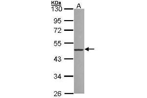 WB Image Sample (30 ug of whole cell lysate) A: 293T 10% SDS PAGE antibody diluted at 1:1000 (ZNF277 anticorps)