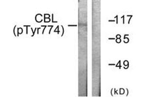 Western blot analysis of extracts from HeLa cells treated with EGF 200ng/ml 30', using CBL (Phospho-Tyr774) Antibody. (CBL anticorps  (pTyr774))