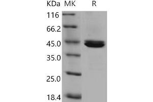 Western Blotting (WB) image for Carboxypeptidase B1 (Tissue) (CPB1) (Active) protein (His tag) (ABIN7194606)