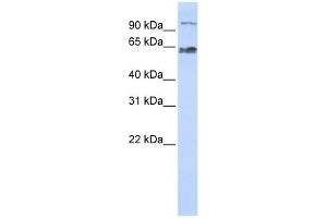 KIAA0892 antibody used at 1 ug/ml to detect target protein. (MAU2/KIAA0892 anticorps  (Middle Region))