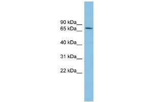 WB Suggested Anti-SENP2 Antibody Titration: 0. (SENP2 anticorps  (Middle Region))