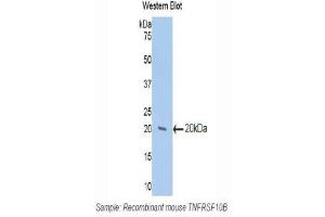 Western Blotting (WB) image for anti-Tumor Necrosis Factor Receptor Superfamily, Member 10b (TNFRSF10B) (AA 233-367) antibody (ABIN1173677)