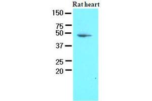 Western Blotting (WB) image for anti-3-phosphoinositide Dependent Protein Kinase-1 (PDPK1) (AA 29-436) antibody (ABIN400866)