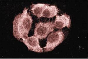 Immunofluorescence staining of A431 cells (Human epithelial carcinoma, ATCC CRL-1555). (PTPN11 anticorps  (AA 1-177))