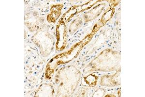 Immunohistochemistry of paraffin-embedded human kidney using [KO Validated] NADPH oxidase 4 (NOX4) Rabbit pAb (ABIN6128328, ABIN6144752, ABIN6144753 and ABIN6215143) at dilution of 1:100 (40x lens). (NADPH Oxidase 4 anticorps  (AA 328-578))