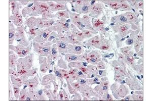 Immunohistochemistry (IHC) image for anti-N-Acylsphingosine Amidohydrolase (Acid Ceramidase) 1 (ASAH1) (AA 25-125) antibody (ABIN782337)