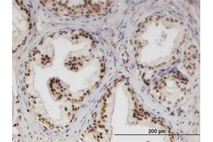 Image no. 1 for anti-Nucleoporin Like 1 (NUPL1) (AA 323-423) antibody (ABIN599498) (NUPL1 anticorps  (AA 323-423))