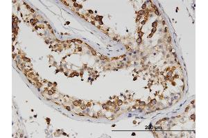 Immunoperoxidase of monoclonal antibody to ZBP1 on formalin-fixed paraffin-embedded human testis.