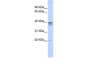 RABGGTB antibody used at 1 ug/ml to detect target protein. (RABGGTB anticorps  (Middle Region))