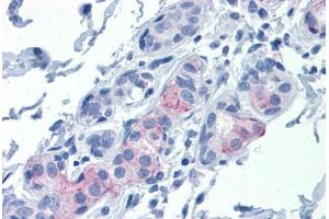 Human Breast: Formalin-Fixed, Paraffin-Embedded (FFPE)