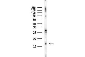 Western blot analysis of lysates from Rat liver, using Histone H3 Antibody at 1/1000 dilution.