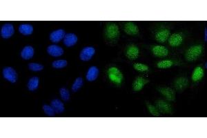 IF analysis of PHF21B using anti-PHF21B antibody (ABIN7601150). (PHF21B anticorps  (AA 291-499))
