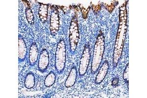 IHC analysis of Cytokeratin 20/Krt20 using anti-Cytokeratin 20/Krt20 antibody (ABIN7601133). (KRT20 anticorps  (AA 29-431))