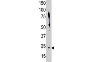 The BID polyclonal antibody  is used in Western blot to detect BID in HL-60 cell lysate.