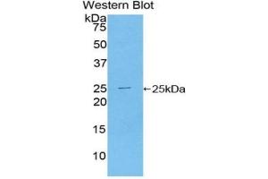 Western blot analysis of the recombinant protein. (TICAM2 anticorps  (AA 34-241))