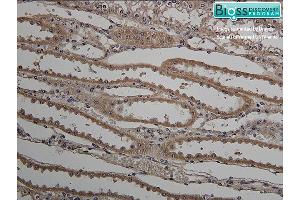 Formalin-fixed and paraffin embedded horse kidney labeled with Anti- HSD11B2 Polyclonal Antibody, Unconjugated (ABIN701680) at 1:200 followed by conjugation to the secondary antibody and DAB staining