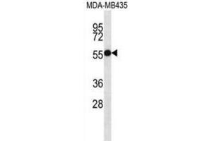 Western Blotting (WB) image for anti-Ankyrin Repeat and SOCS Box Containing 4 (ASB4) antibody (ABIN2997237)