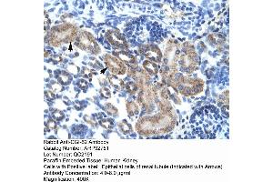 Human kidney (FAM164A anticorps  (C-Term))