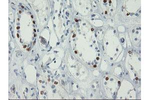 anti-Forkhead Box I1 (FOXI1) (AA 111-350) antibody