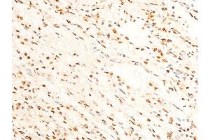 ABIN6267237 at 1/100 staining human TB tissue sections by IHC-P.