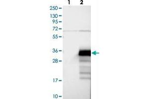 Western blot analysis of Lane 1: Negative control (vector only transfected HEK293T lysate), Lane 2: Over-expression Lysate (Co-expressed with a C-terminal myc-DDK tag (~3. (ZCCHC24 anticorps)