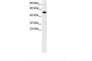 Image no. 3 for anti-Nuclear Receptor Subfamily 5, Group A, Member 1 (NR5A1) (AA 172-221) antibody (ABIN6735774) (NR5A1 anticorps  (AA 172-221))