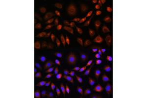 Immunofluorescence analysis of L929 cells using ApoM Rabbit pAb (ABIN6127365, ABIN6137030, ABIN6137031 and ABIN6220968) at dilution of 1:100. (Apolipoprotein M anticorps  (AA 23-188))