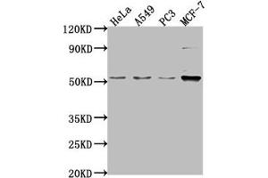 Western Blot Positive WB detected in: Hela whole cell lysate, A549 whole cell lysate, PC-3 whole cell lysate, MCF-7 whole cell lysate All lanes: FKTN antibody at 1:2000 Secondary Goat polyclonal to rabbit IgG at 1/50000 dilution Predicted band size: 54, 50 kDa Observed band size: 54 kDa (Fukutin anticorps  (AA 87-276))