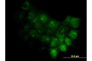 Immunofluorescence of monoclonal antibody to S100A7 on A-431 cell. (S100A7 anticorps  (AA 1-101))