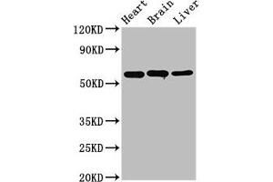 Western Blot Positive WB detected in: Rat heart tissue, Rat brain tissue, Mouse liver tissue All lanes: ALDH5A1 antibody at 3. (ALDH5A1 anticorps  (AA 48-535))