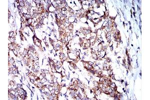 Immunohistochemistry (IHC) image for anti-BCL2/adenovirus E1B 19kDa Interacting Protein 3 (BNIP3) (AA 50-155) antibody (ABIN5858883) (BNIP3 anticorps  (AA 50-155))