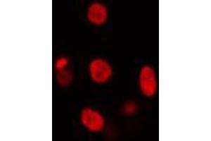 ABIN6274439 staining HuvEc cells by IF/ICC. (SMARCC2 anticorps  (Internal Region))
