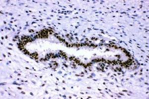 IHC analysis of p95 NBS1 using anti-p95 NBS1 antibody (ABIN3043282). (Nibrin anticorps  (C-Term))