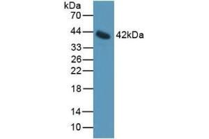 Western blot analysis of Mouse Serum. (IL11RA anticorps  (AA 194-329))