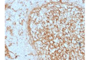 Formalin-fixed, paraffin-embedded human Tonsil stained with CD14 Mouse Monoclonal Antibody (LPSR/2397).