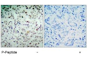 Image no. 1 for anti-Retinoblastoma 1 (RB1) (pSer780) antibody (ABIN196843) (Retinoblastoma 1 anticorps  (pSer780))