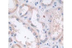 IHC-P analysis of Human Tissue, with DAB staining. (GZMK anticorps  (AA 27-264))
